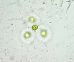 Asterococcus superbus