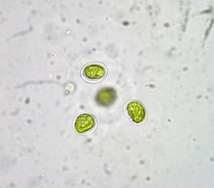 Asterococcus superbus