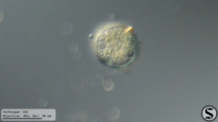 Arcella hemisphaerica