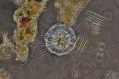 Actinosphaerium