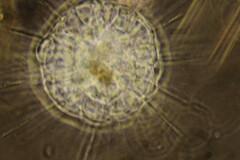 Actinosphaerium