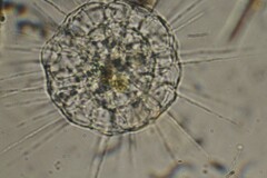 Actinosphaerium