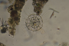 Actinosphaerium