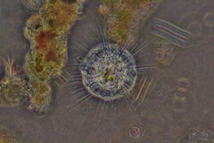 Actinosphaerium