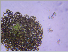 Dolichospermum lemmermannii