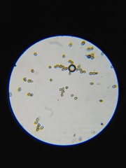 Puccinia cressae
