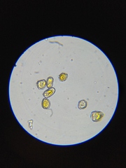 Puccinia cressae