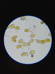 Puccinia cressae