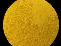 Hohenbuehelia angustata