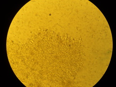 Hohenbuehelia angustata