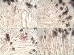 Graphis cincta