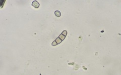 Hysterium angustatum