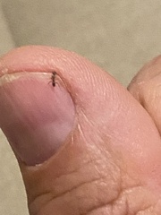 Linepithema humile