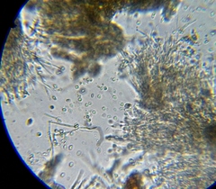 Eustilbum aureum