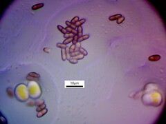 Chaenothecopsis pusilla