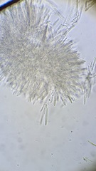 Mollisia hydrophila