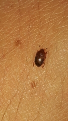 Epuraea