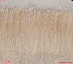 Hymenoscyphus imberbis