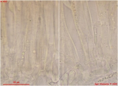 Hymenoscyphus imberbis