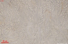 Hymenoscyphus imberbis