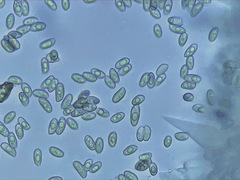 Macrocystidia