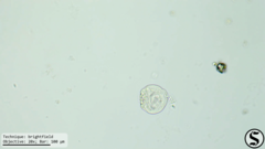 Vorticella campanula