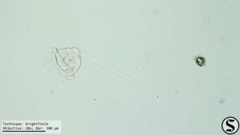 Vorticella campanula