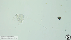 Vorticella campanula