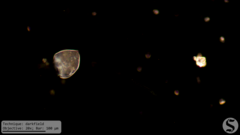 Vorticella campanula