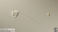 Vorticella campanula