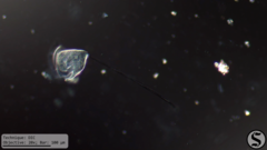 Vorticella campanula