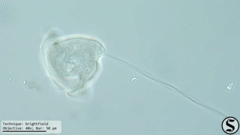 Vorticella campanula