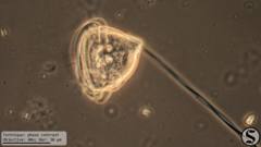 Vorticella campanula