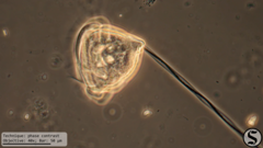 Vorticella campanula