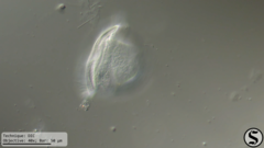 Vorticella campanula