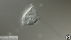 Vorticella campanula