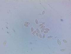 Mycogone calospora