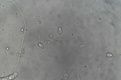 Phaeohelotium undulatum