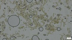 Lycoperdon dermoxanthum