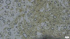 Lycoperdon dermoxanthum