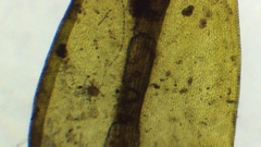 Grimmia ramondii