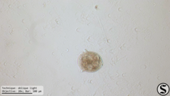 Vorticella campanula