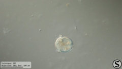 Vorticella campanula