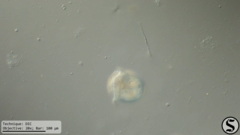 Vorticella campanula