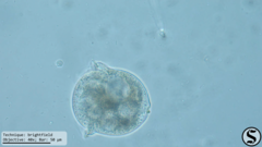 Vorticella campanula