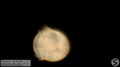 Vorticella campanula