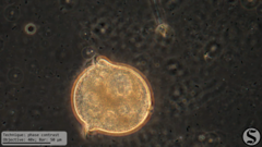 Vorticella campanula