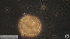 Vorticella campanula