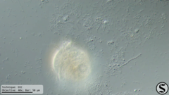 Vorticella campanula