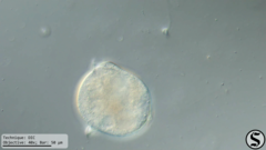 Vorticella campanula